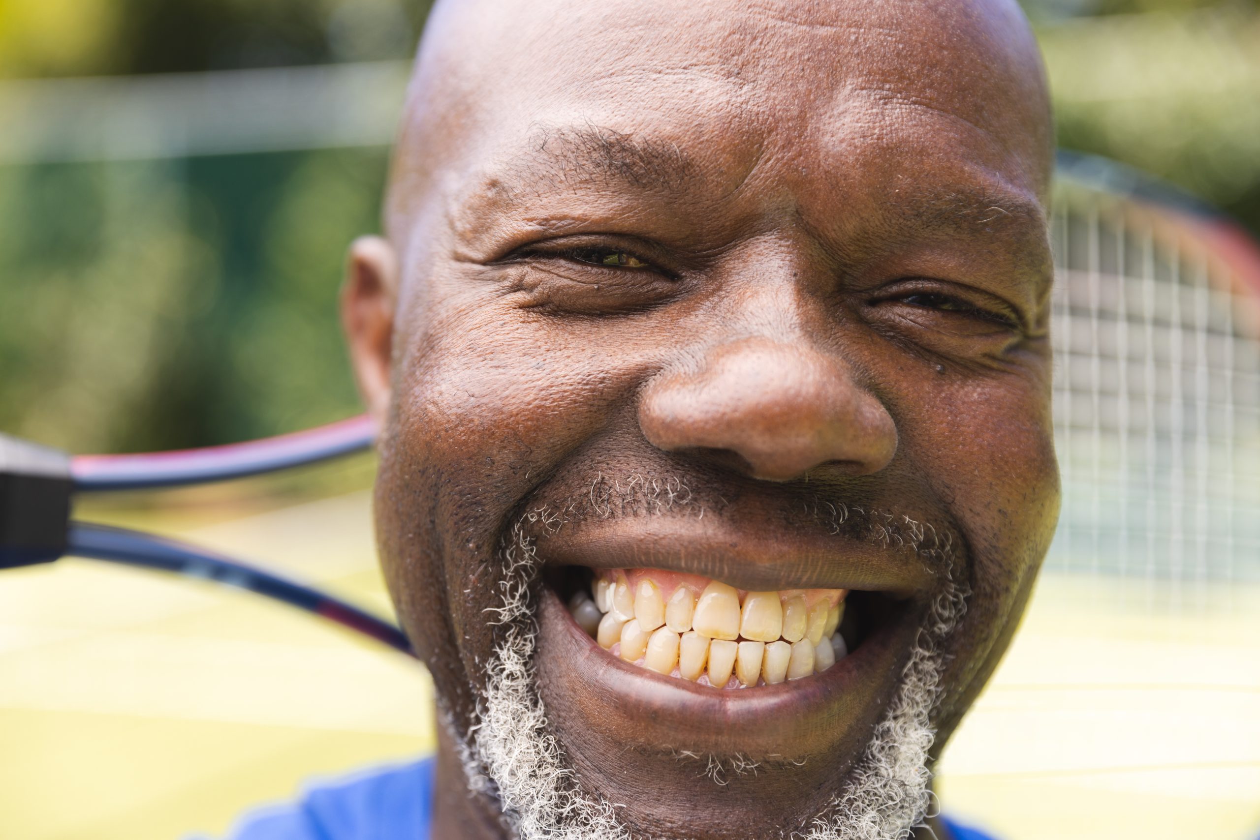 a smiling dental patient who has had all on 4 dental implants.